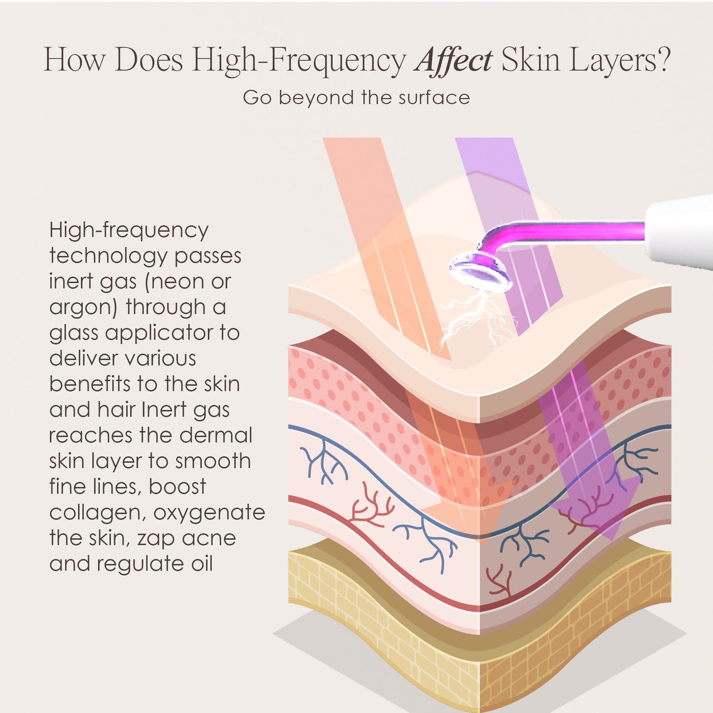 Lasentis™ High Frequency Therapy Kit: The Dermatologist's Secret for Acne & Wrinkles