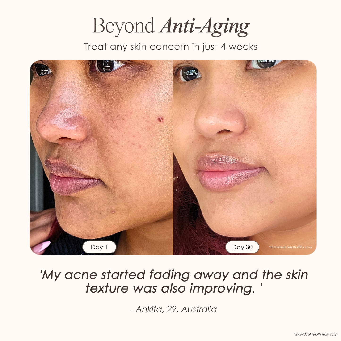 Lasentis™ High Frequency Therapy Kit: The Dermatologist's Secret for Acne & Wrinkles